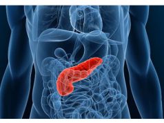 Urine Test to help detect pancreatic cancer