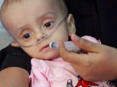 Yemen aid summit seeks to pull nation from brink