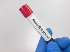 Potential case of meningitis being investigated in Belize