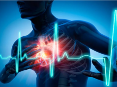 Barbados health officials concerned over number of heart attack admissions